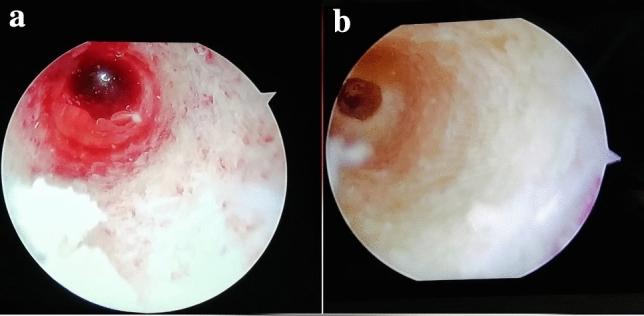 Fig. 4