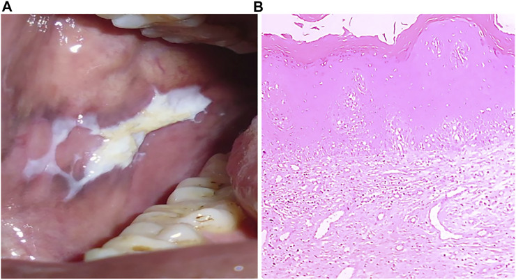 FIGURE 3