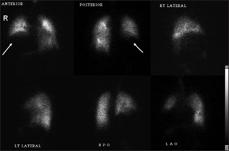 Figure 2a