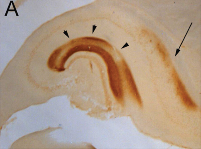 graphic file with name 10.1016_j.jfms.2010.09.004-fig4.jpg