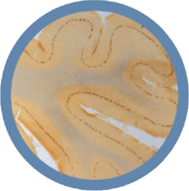 graphic file with name 10.1016_j.jfms.2010.09.004-fig2.jpg