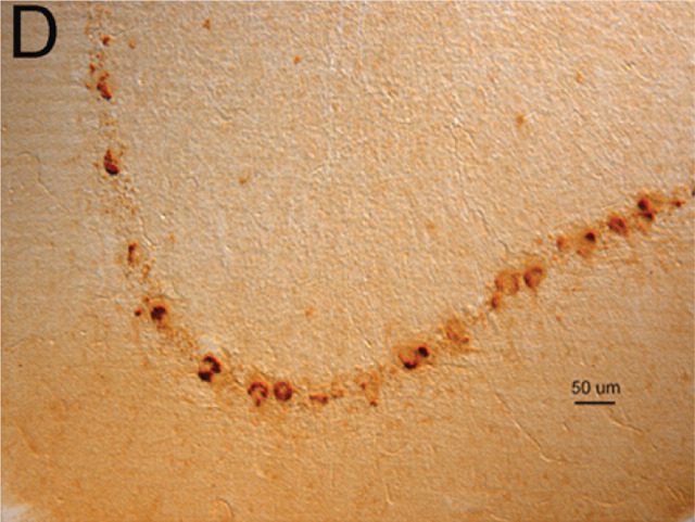 graphic file with name 10.1016_j.jfms.2010.09.004-fig7.jpg