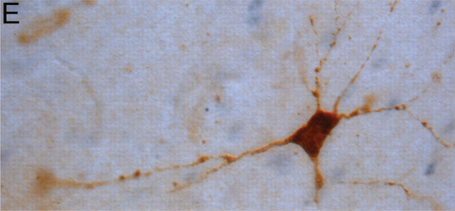 graphic file with name 10.1016_j.jfms.2010.09.004-fig8.jpg
