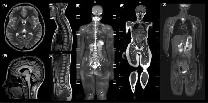 FIGURE 2