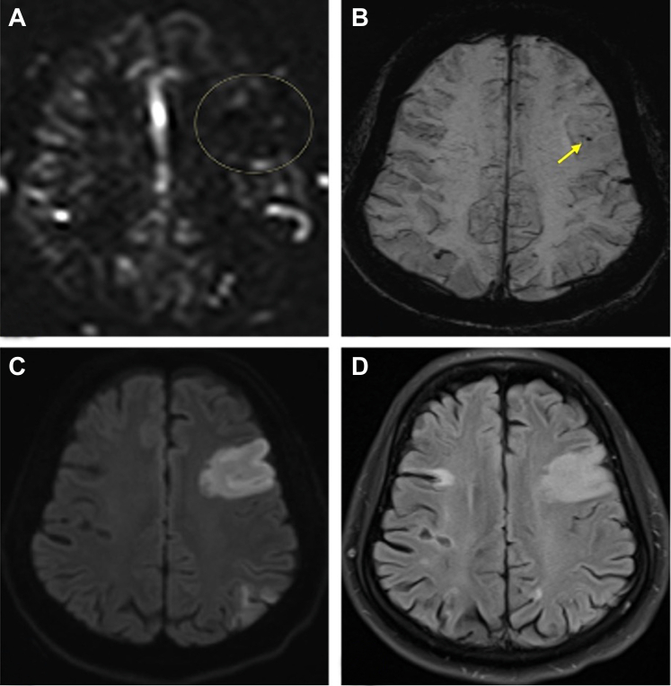 Figure 1