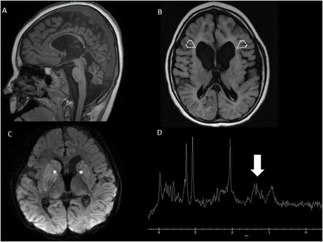 Fig. 3