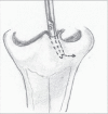 Figure 10b