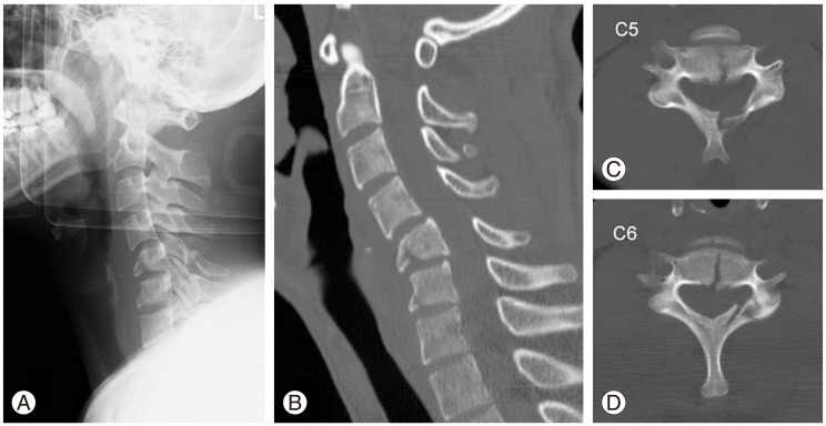 Fig. 2