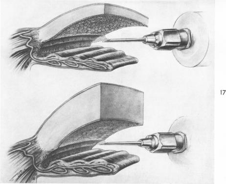 Fig. 17