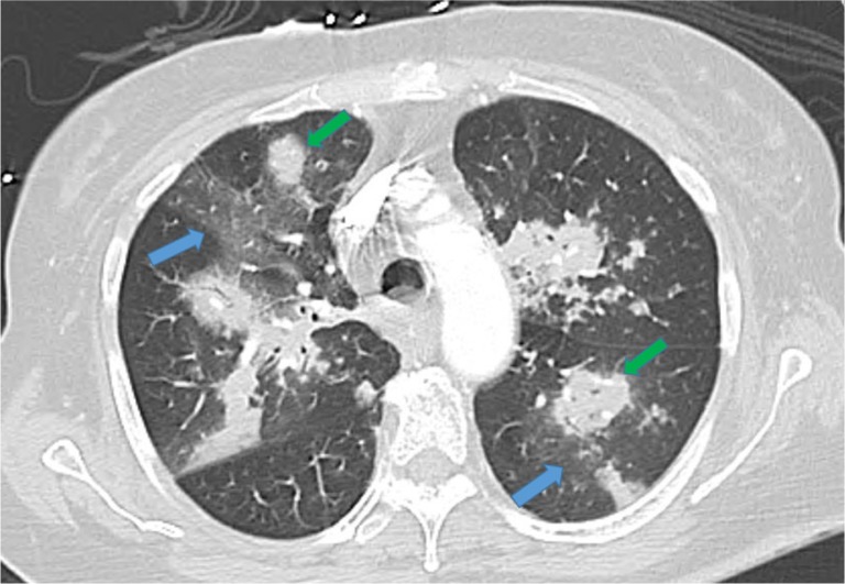 Fig. 1