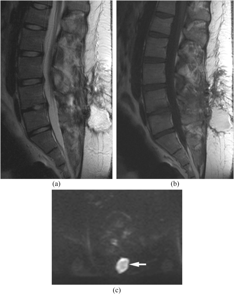 Figure 12.