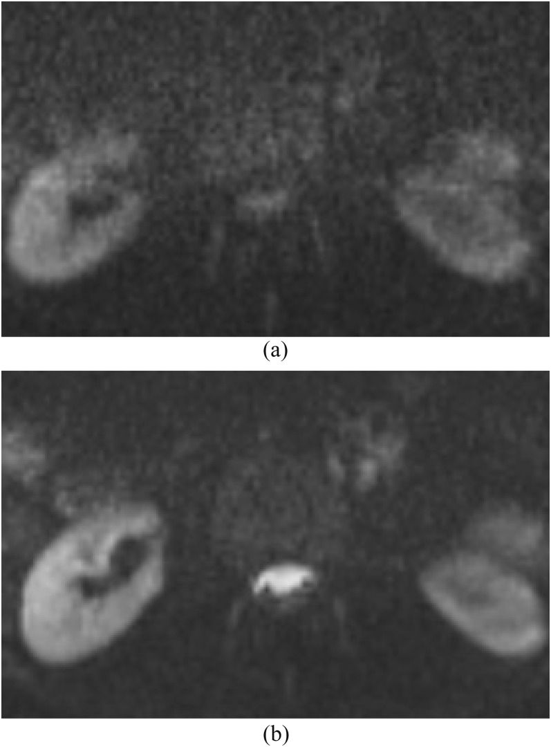 Figure 13.