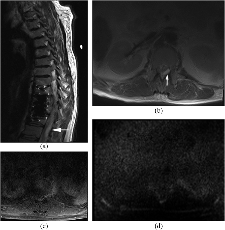 Figure 14.