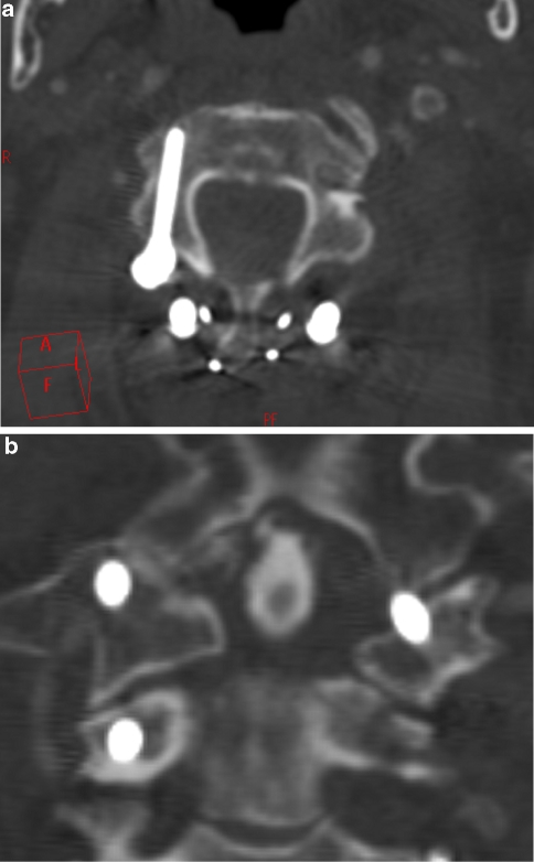 Fig. 2