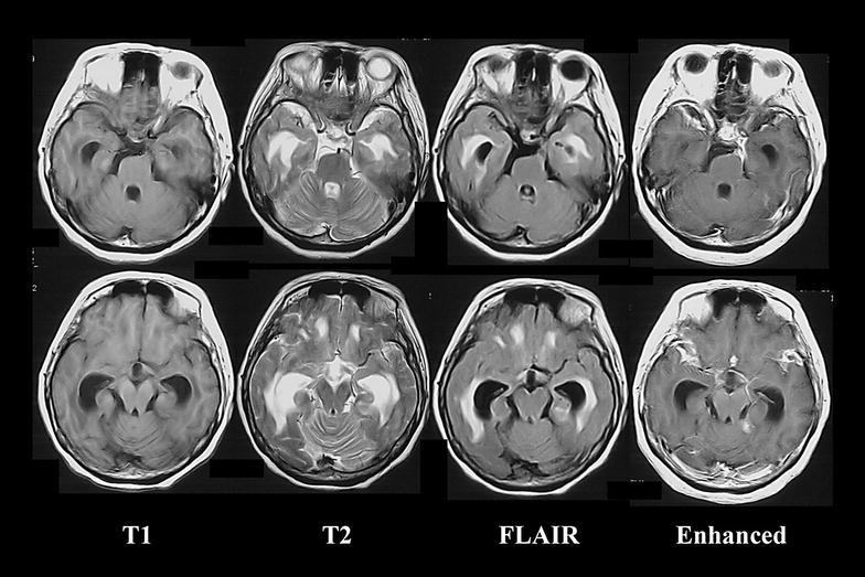 Fig. 1