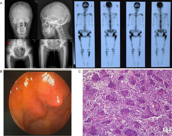 Fig 3