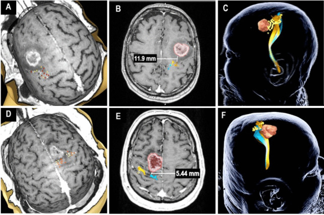 Fig. 2