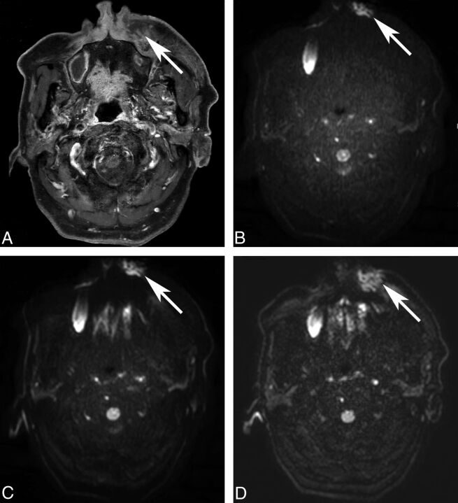 Fig 2.