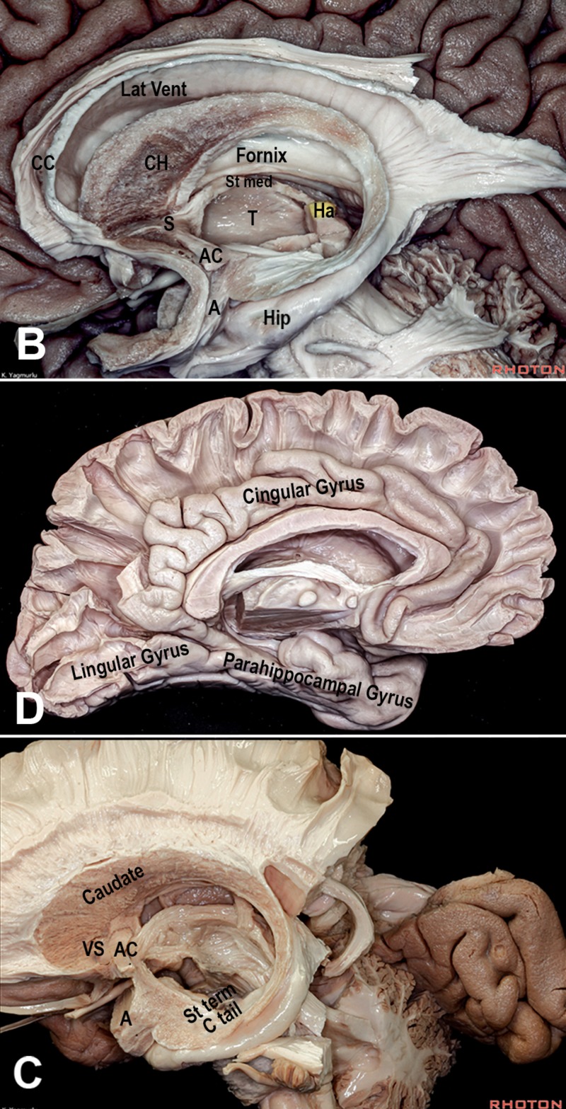 The Evolutionary Development of the Brain As It Pertains to ...