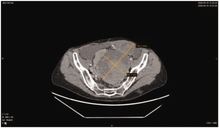 Figure 2.