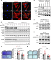 Figure 5. Depletion of CaMKK2 leads to increased phosphorylation of VASP at the Serine 239 residue, which leads to impaired cytoskeletal assembly and cell motility. A, Representative images showing impaired cytoskeletal assembly in CaMKK2-KO cells. Visualization of F-actin by phalloidin staining in CaMKK2-WT (Ctrl #1) and CaMKK2-KO (KK2-KO #1) cells revealed almost complete loss of ventral stress fibers in cells lacking CaMKK2 expression. Yellow arrows, dorsal stress fibers; white arrows, ventral stress fibers; yellow bracket, transverse arcs; green arrowhead, leading edge; yellow arrowhead, contractile rear of the cell. Scale bar, 10 μm. B, Representative blot showing increased phosphorylation of VASP at Serine 239 in CaMMK2 KO cell clones. C, Representative blot showing VASP phosphorylation at Serine 239 is enhanced in CaMKK2-KO cells in response to ionomycin (1 μmol). Cells were treated with either DMSO or ionomycin (1 μmol/L) with CaCL2 (1 mmol/L) for varying time periods (as indicated). D and E, Inhibition of CaMKK2 (STO-609, 10 μmol) increases phosphorylation of VASP [especially with ionomycin (1 μmol; 2 hours)] in metastatic MDA-MB-231-4175 cells (D) and BT-20 cells (E). DMSO or STO-609–treated cells were exposed to either DMSO or ionomycin (1 μmol/L) with CaCL2 (1 mmol/L) for 2 hours before immunoblotting. F and G, CaMKK2 inhibition decreases migration of MDA-MB-231-4175 cells (F) and BT20 cells (G) in vitro. DMSO or STO-609–treated cells were exposed to either DMSO or ionomycin with CaCL2 (see D and E) before migration assays were performed. Data are plotted as mean ± SEM; n = 4–5 random fields measurements from four individual experiments done in duplicate. *, P < 0.05; **, P < 0.01; ***, P < 0.001. P values were calculated using unpaired Student t test.