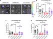 Figure 3. Genetic ablation of CaMKK2 impairs metastasis from the primary tumor in vivo. A, Six-week-old female nude mice were orthotopically injected in the mammary fat pad with two control cell clones, Ctrl #1 (n = 9), Ctrl #3 (n = 8); two CaMKK2-KO cell clones, KK2-KO #1 (n = 9), KK2-KO #2 (n = 6); and the CaMKK2 KO cell clones with reexpression of CaMKK2, KO #1-KK2 (n = 8) and KO #2-KK2 (n = 7). All clones were derived from the parental MDA-MB-231–4175 cell line. The mice were sacrificed after tumors reached approximately 2,500 mm3, and the lung and liver metastatic burden was analyzed ex vivo. Representative BLI images showing lung metastatic foci were visualized. B–D, Quantitation of the number of metastatic foci in the lung (B) and liver (C), and total metastatic burden (includes metastatic foci in the liver and lung taken together for each animal; D). Data, mean ± SEM. *, P < 0.05; **, P < 0.01; ns, nonsignificant; by Student t test.