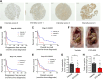 Figure 8. CaMKK2 expression is associated with lower survival rates in patients with HGSOC. A, Representative photomicrographs of tumor microarray sections stained for CaMKK2 by immunohistochemistry, with corresponding intensity scores (×10 magnification). B and C, PFS (B) and OS (C) of patients with stage III HGSOC were evaluated and demonstrated that low CaMKK2 expression (intensity score < 3) correlated with longer median PFS (19.1 months vs. 6.2 months, P = 0.0242) and OS (60.6 vs. 17.1 months, P = 0.0180) than patients with high expression. D, PFS of patients with stage II to IV HGSOC were evaluated, which demonstrated that low CaMKK2 expression correlated with longer median PFS than patients with high expression (14.7 months vs. 14.5 months, P = 0.0453). E, OS of patients with stage II to IV were evaluated and showed a trend toward higher median OS in patients with low expression (58.0 months vs. 32 months, P = 0.2745). F, Eight-week-old female nude mice were inoculated with SKOV3ip1 cells (intraperitoneally) and received vehicle (control) or STO-609. Representative images (F), weight of metastatic tumor burden (G), and weight of non-pelvic metastasis (H) are shown (n = 15 per group). Data, mean ± SEM. *, P < 0.05; **, P < 0.01; by Student t test (G and H) and log-rank test (B–E).