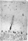 416-2