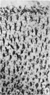 416-1