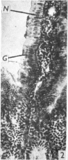 416-1