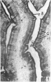 416-1