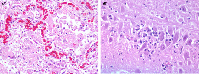 Figure 10.14