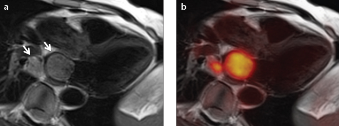 Figure 9. a, b.