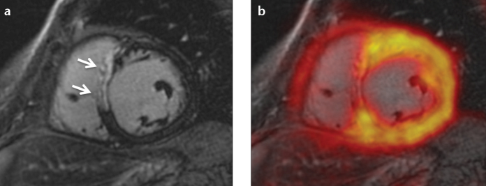 Figure 8. a, b.