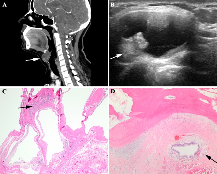 Fig. 1