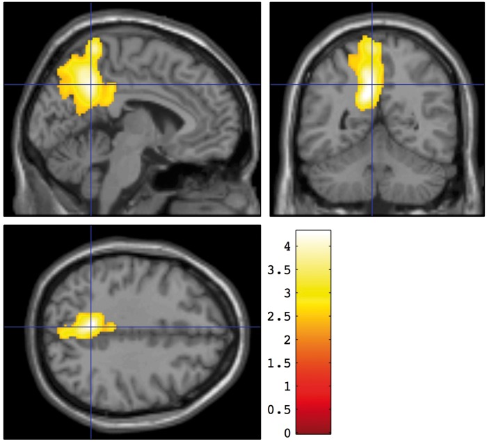 Figure 3.