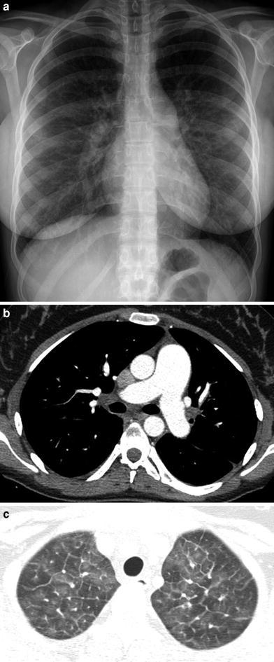 Fig. 22
