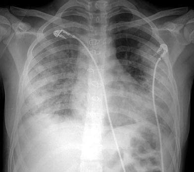 Fig. 14