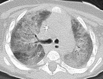 Fig. 10