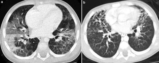 Fig. 18