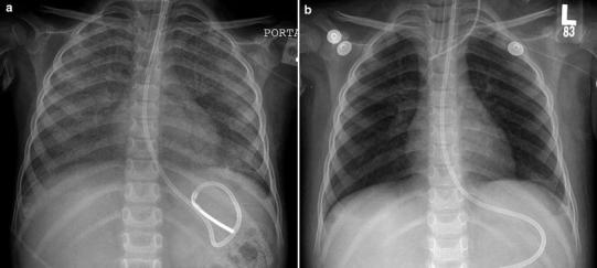 Fig. 11