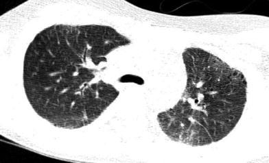 Fig. 20