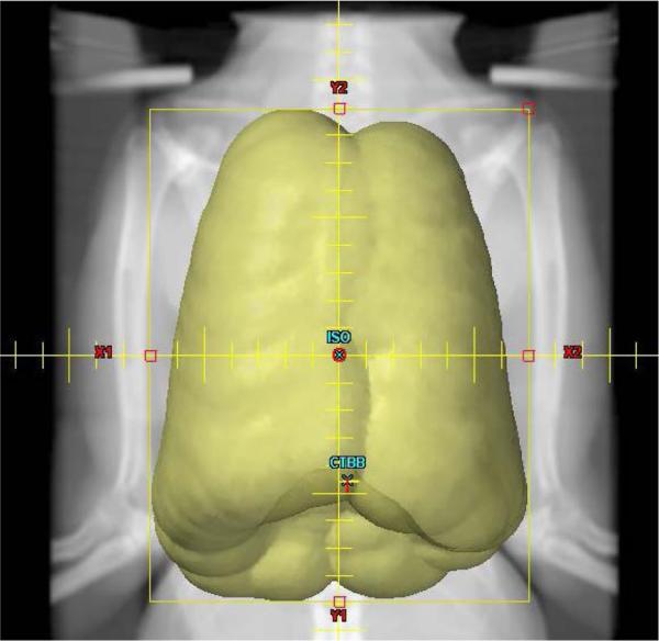 Fig. 3a 3b