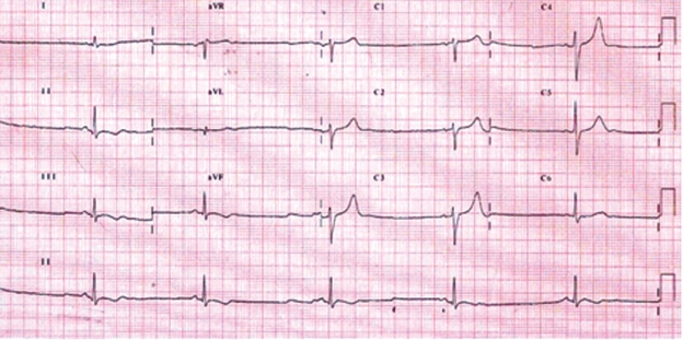 Figure 2: