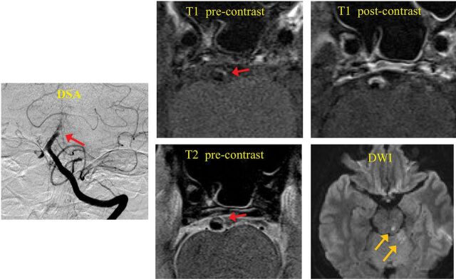 Fig 3.