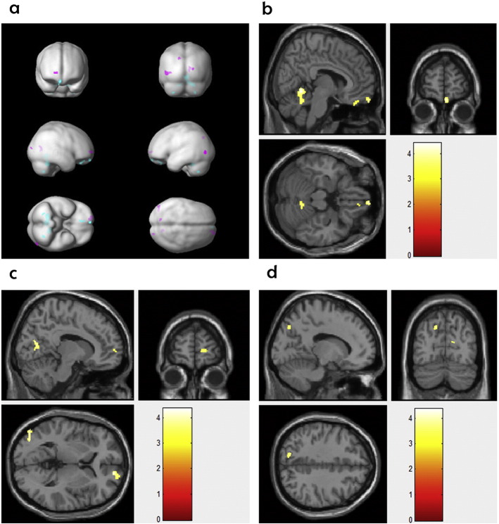 Fig. 1