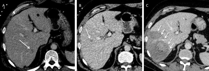 Figure 14.