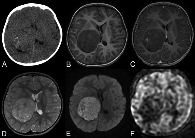 Fig 2.