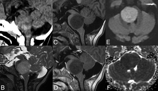 Fig 4.