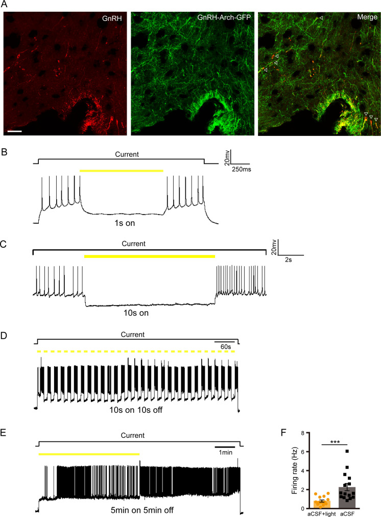 Figure 5—figure supplement 1.